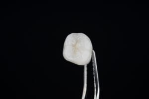 The Comprehensive Guide to Dental Crowns